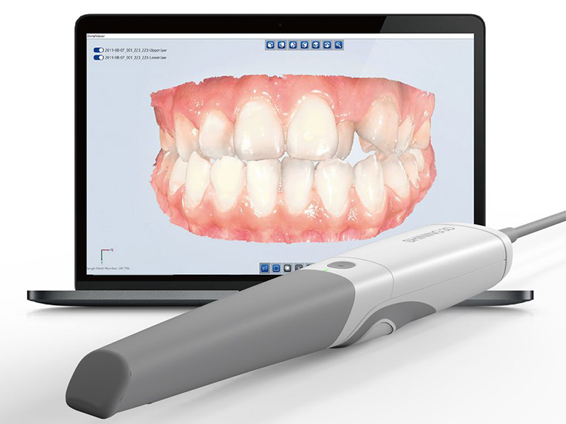 dentista scanner chirurgia