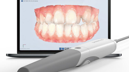 Scanner Intraorale