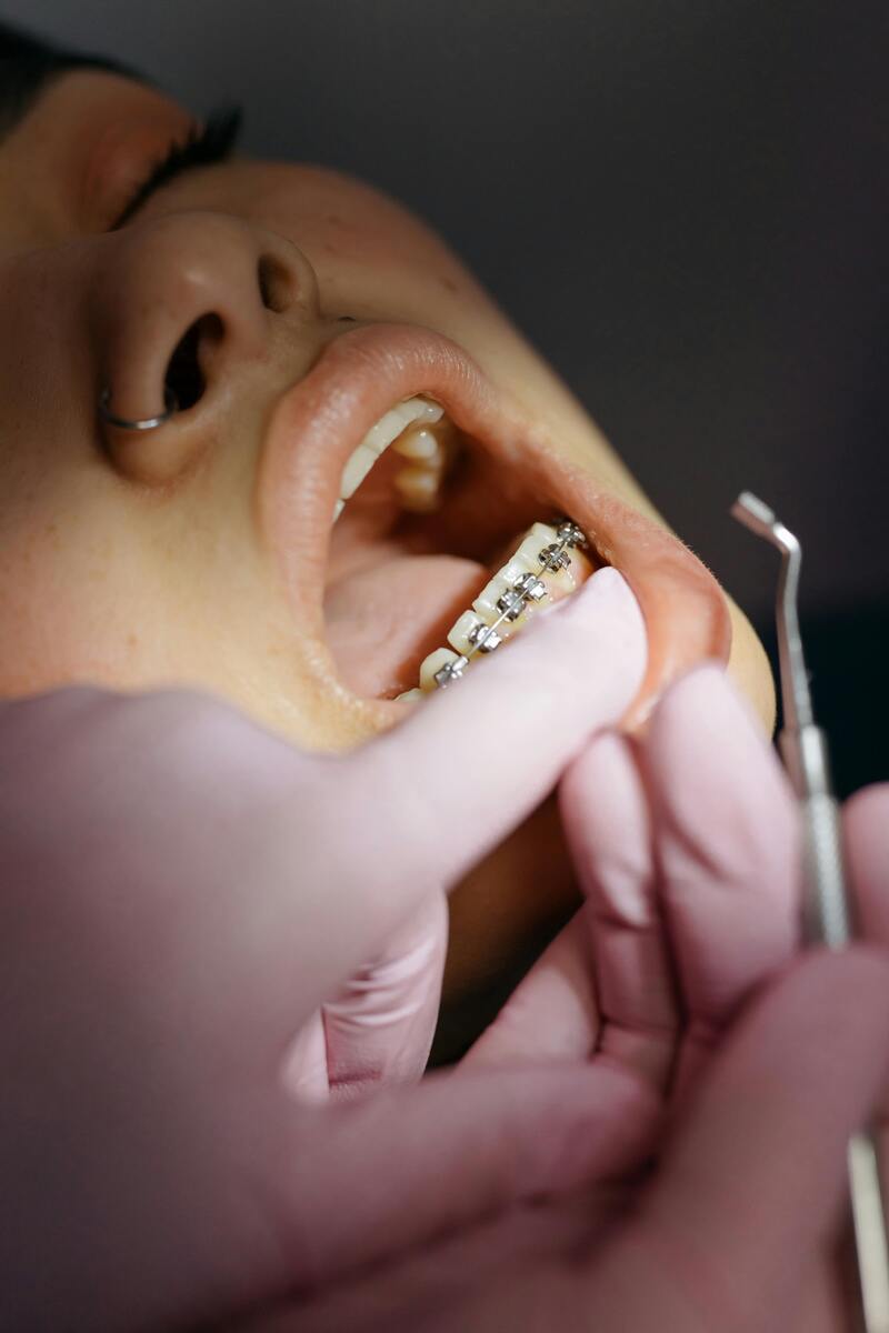 apparecchio fisso