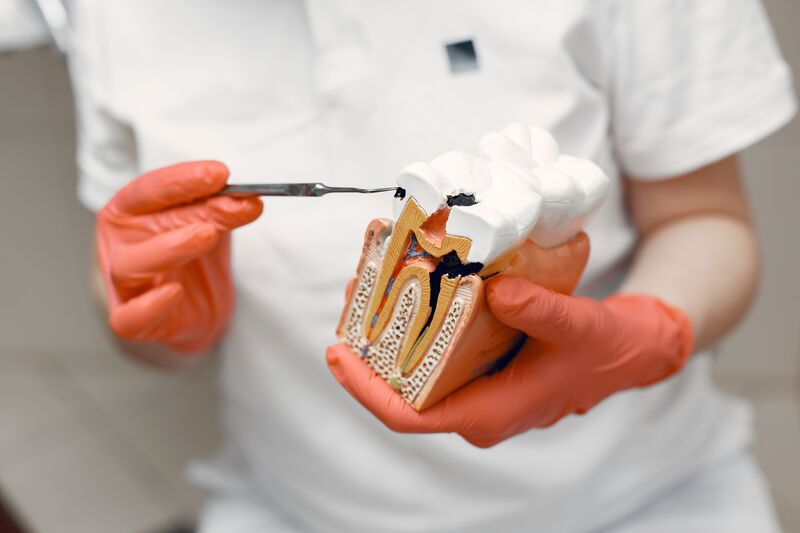 devitalizzazione dente